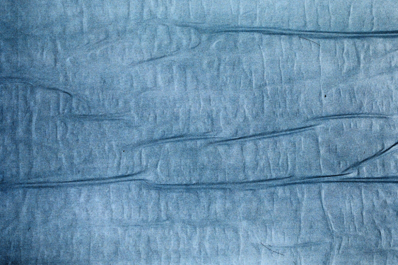 veins